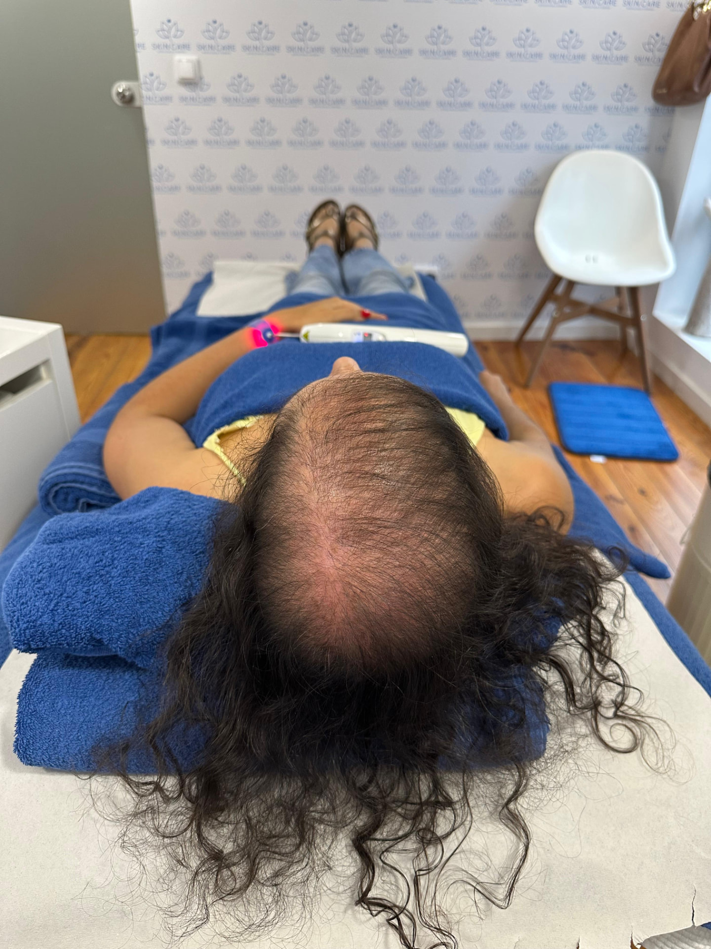 Terapia capilar na Skincare Lisboa